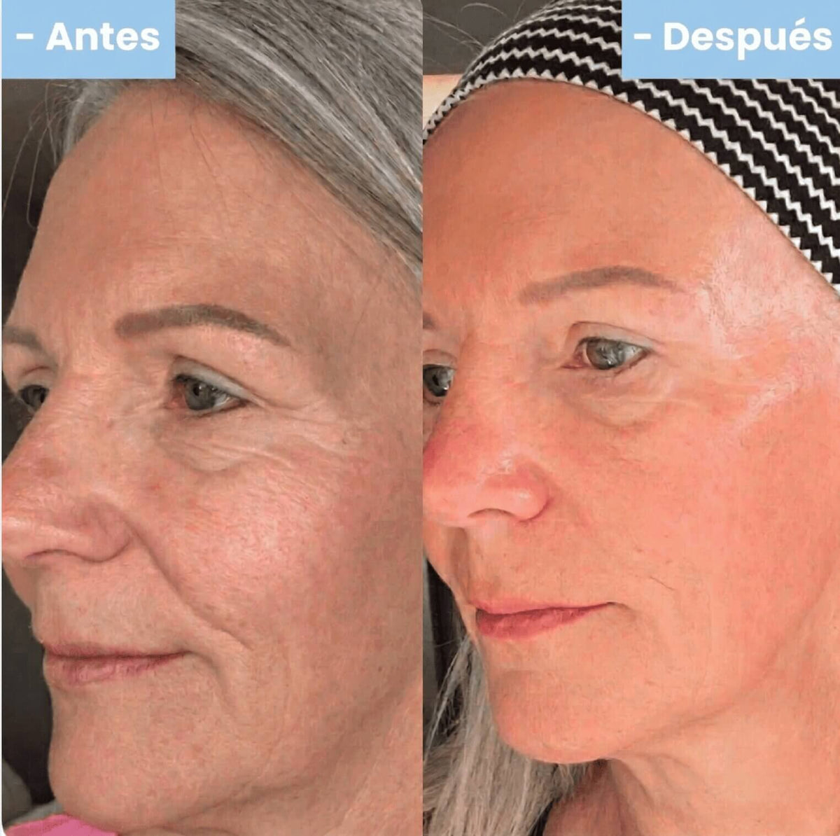 Crema Nida Facial Rejuvenecedora Coreana