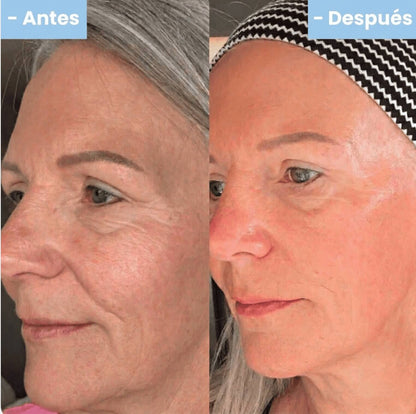 Crema Nida Facial Rejuvenecedora Coreana